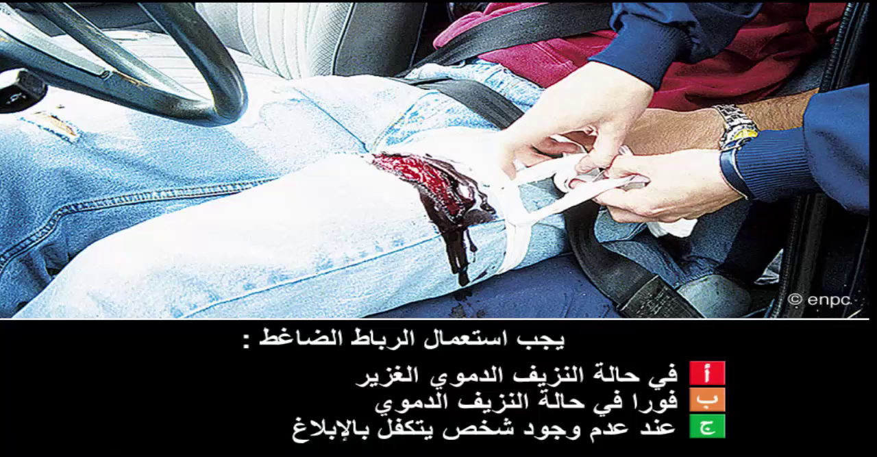 الاسعافات الأولية (صنف ب)